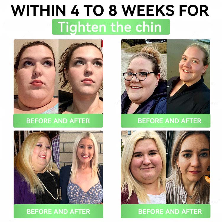 Alcuras® Moringa 8-Benefit Slimming & Metabolic Nano Microneedle（changes in 7 days)  For obesity, Loose Skin,diabetes, sleep apnea, joint issues, and more