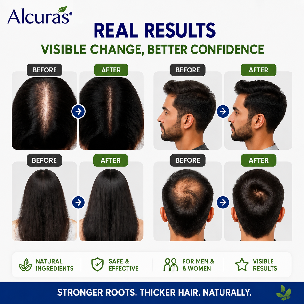 Alcuras® Herbal Shampoo – Anti-Hair Thinning