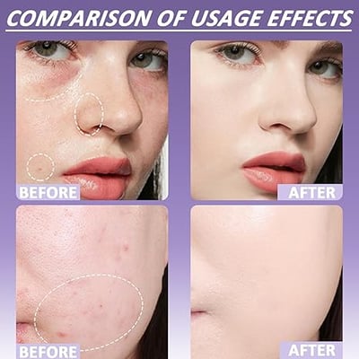 🎉Soft Matte Cream Concealer