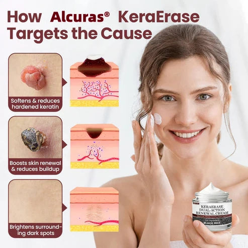 Alcuras® KeraErase Dual-Action Renewal Cream