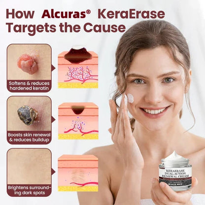 Alcuras® KeraErase Dual-Action Renewal Cream