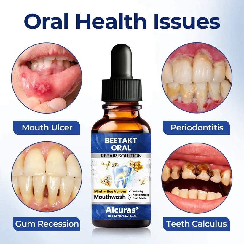 Last Day 49% OFF🔥Alcuras® BeeTakt Oral Repair Solution