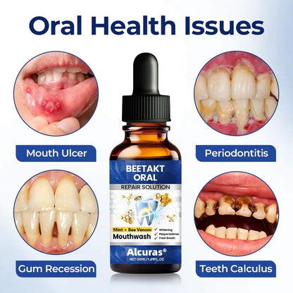 Last Day 49% OFF🔥Alcuras® BeeTakt Oral Repair Solution