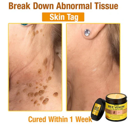 🎁Alcuras™ Bee Poison All-in-One Cream🍀