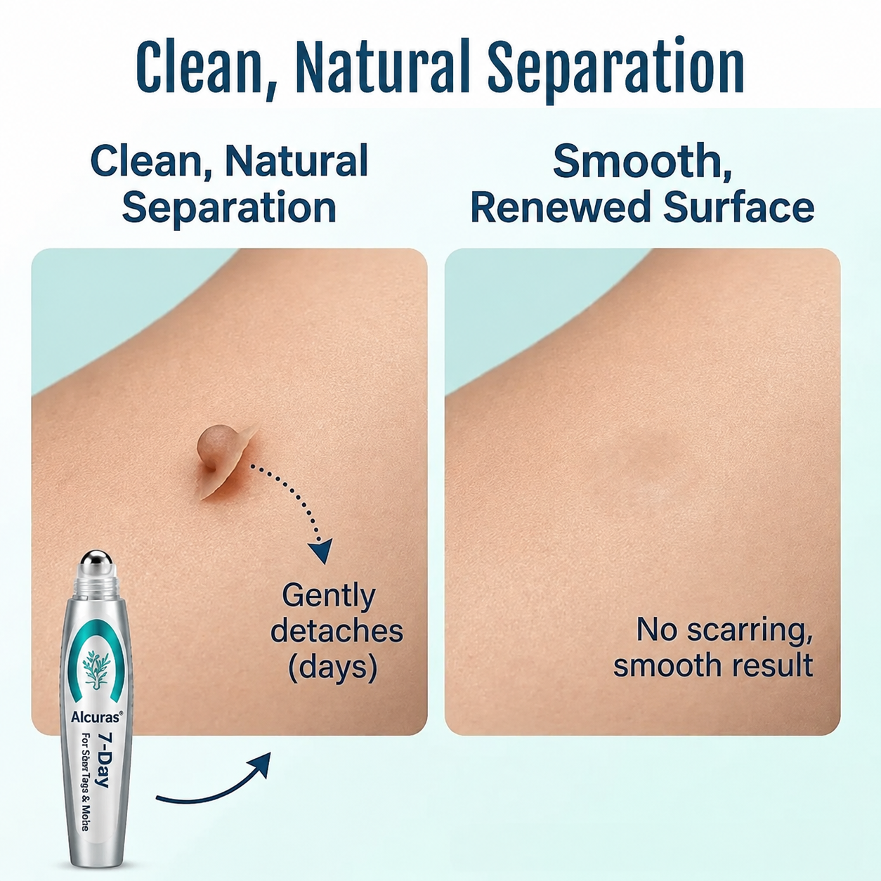 Alcuras® SpotlessPro 7-Day Advanced Blemish & Tag Eraser