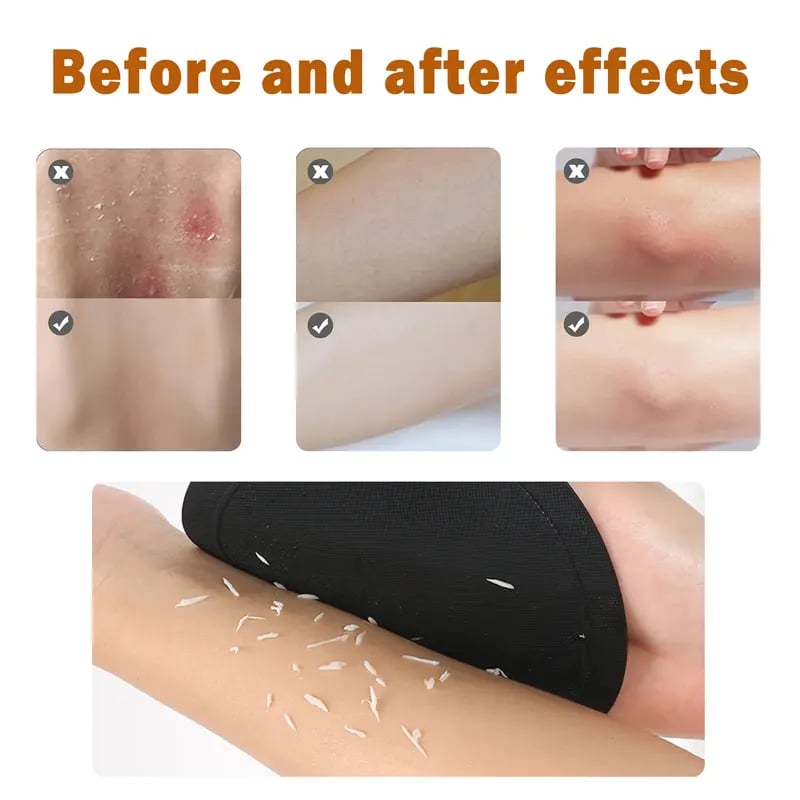 Rubber Body Exfoliating Gloves - Dead Skin Remover After Shower & Bath