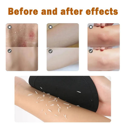 Rubber Body Exfoliating Gloves - Dead Skin Remover After Shower & Bath