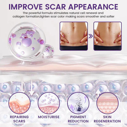 🔥Alcuras® ReGenScar Stem Cell Scar Gel