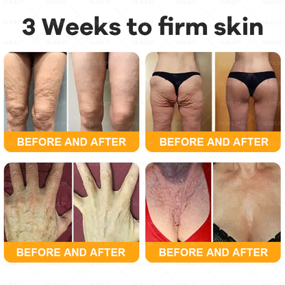 Made and Shipped from USA 🌟🌟VLSVLS® Bee Venom Comprehensive Cream  LAST DAY 80% OFF(Sagging Skin, Fine Lines, Loss of Firmness, Flat Bust, Drooping Hips, and More)