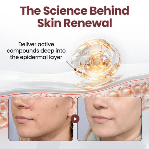 Alcuras® KeraErase Dual-Action Renewal Cream