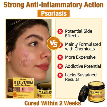 💥HOT SEAL📢Alcuras™ Bee Poison All-in-One Cream