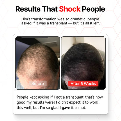 🧑‍⚕️Red Light Therapy Hair Growth Cap🧢(Results were seen in as little as 6–8 weeks)