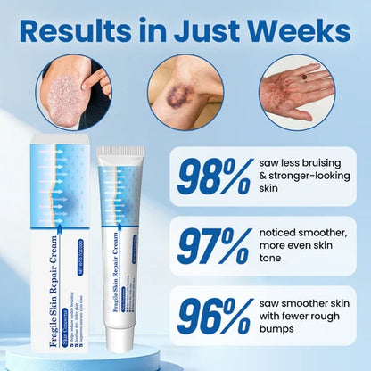 Alcuras® Fragile Skin Repair Cream🛡️🌿 Multi-Repair for Bruises, Dryness & Spots