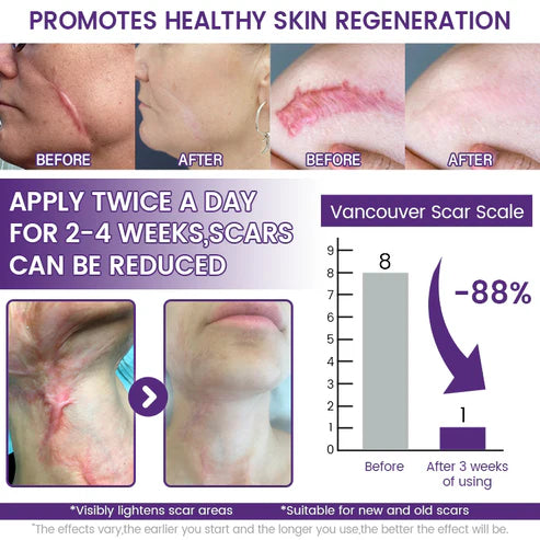 🔥Alcuras® ReGenScar Stem Cell Scar Gel