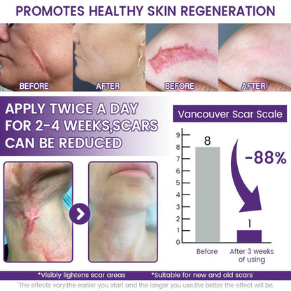🔥Alcuras® ReGenScar Stem Cell Scar Gel