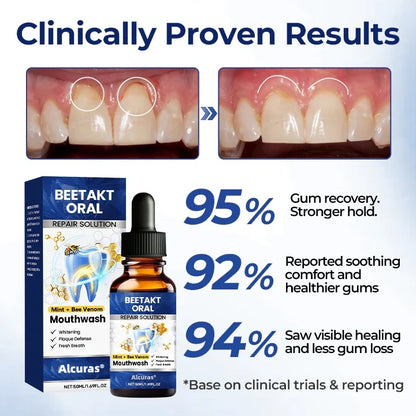 Last Day 49% OFF🔥Alcuras® BeeTakt Oral Repair Solution
