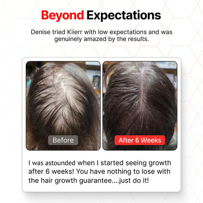 🧑‍⚕️Red Light Therapy Hair Growth Cap🧢(Results were seen in as little as 6–8 weeks)