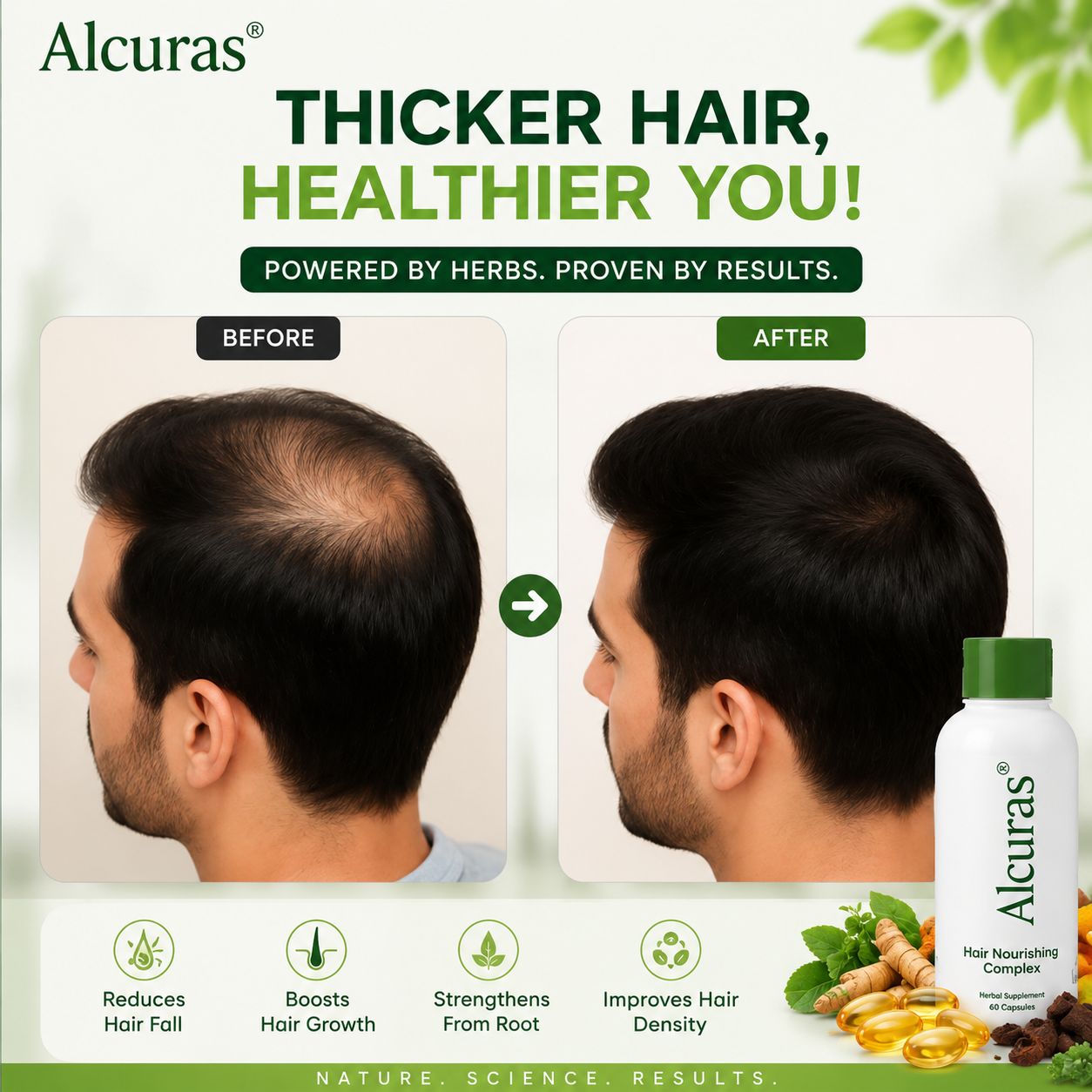 Alcuras® Herbal Shampoo – Anti-Hair Thinning