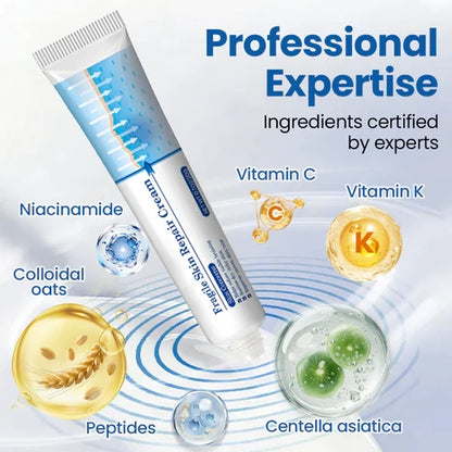 Alcuras® Fragile Skin Repair Cream🛡️🌿 Multi-Repair for Bruises, Dryness & Spots