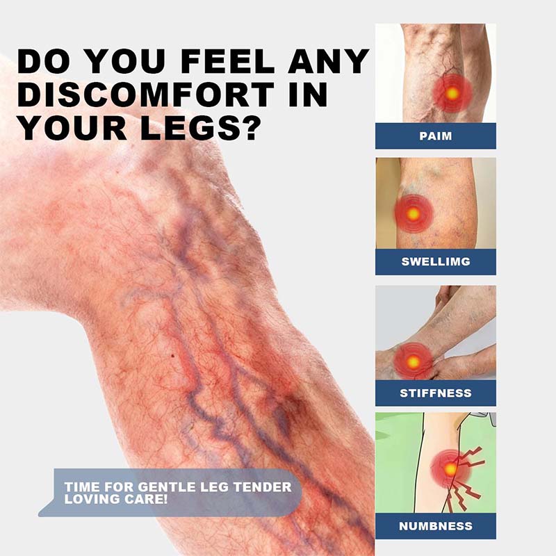 Alcuras® Herbal Varicose Veins Cream, Leg Relief Care🦵