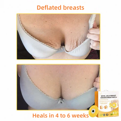 Alcuras®🩰 Breast Enhancement Patch with Royal Jelly-Safe for use while breastfeeding.