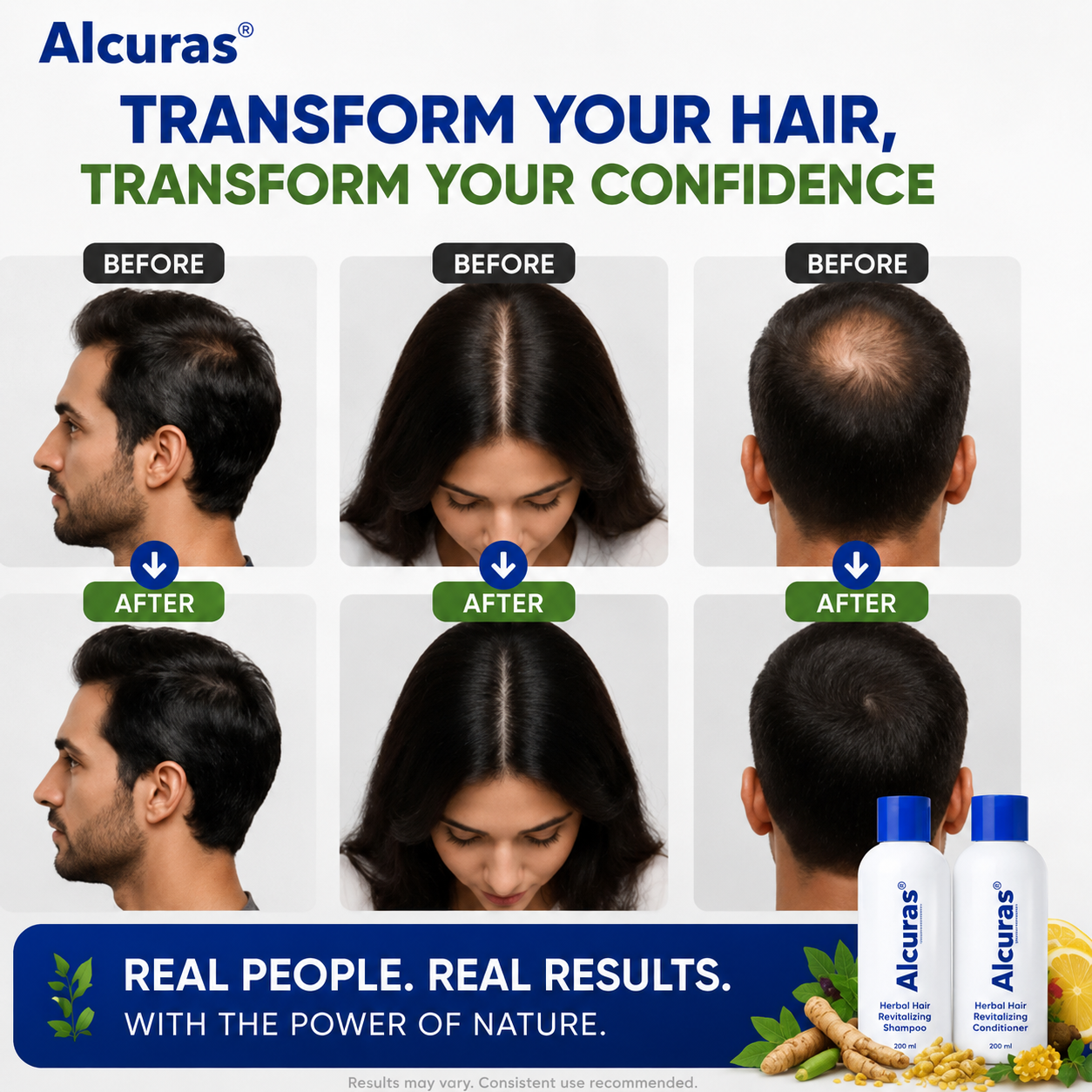 Alcuras® Herbal Shampoo – Anti-Hair Thinning
