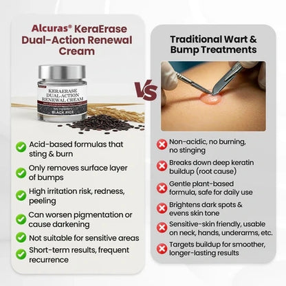 Alcuras® KeraErase Dual-Action Renewal Cream
