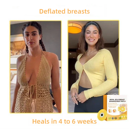 Alcuras®🩰 Breast Enhancement Patch with Royal Jelly-Safe for use while breastfeeding.