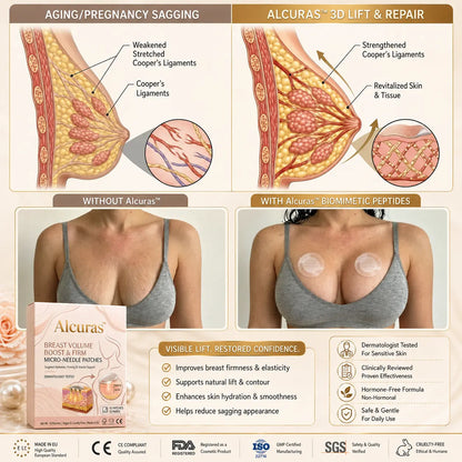 Alcuras®🥛Targeted Breast Enhancement Advanced Nano Microneedle Patch💃