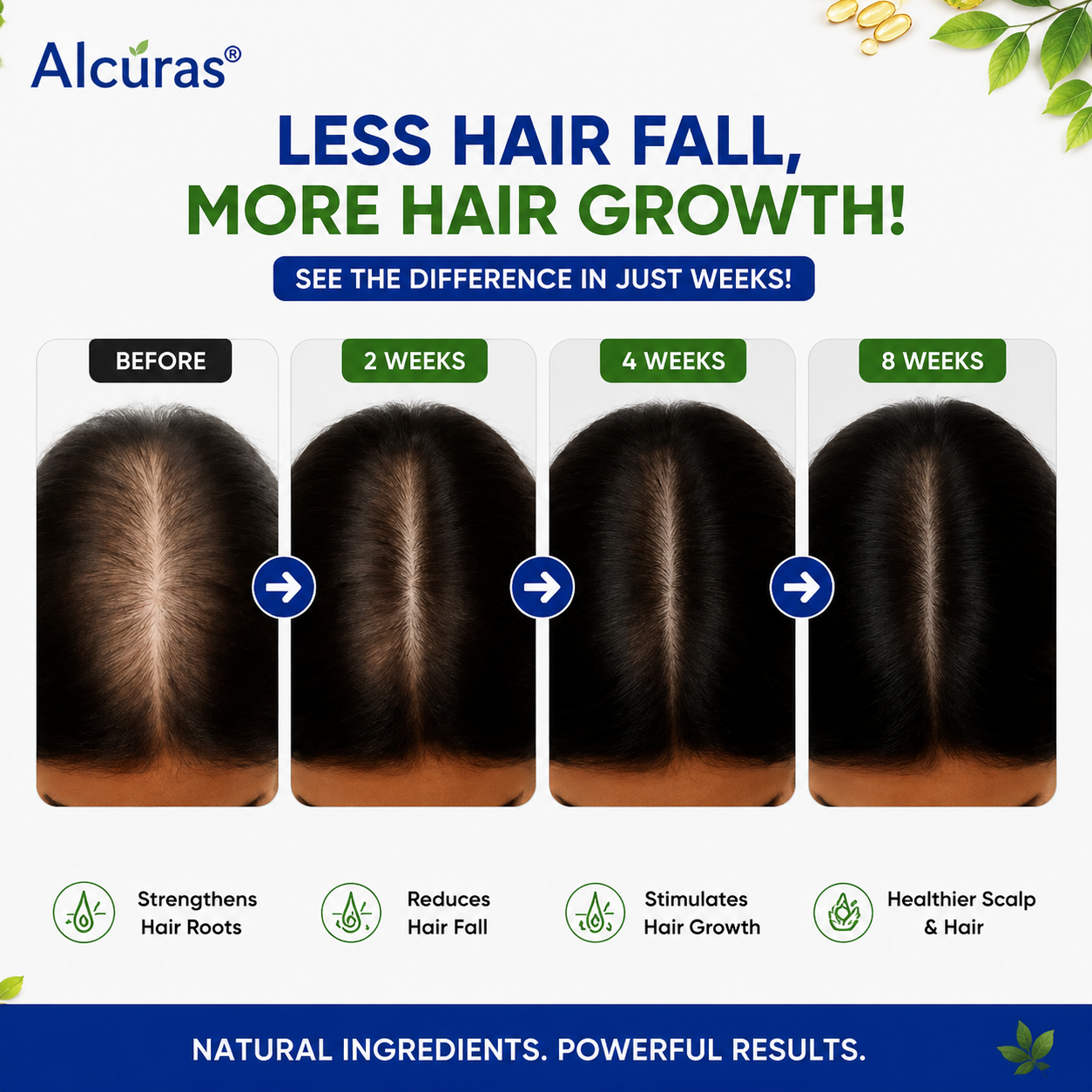 Alcuras® Herbal Shampoo – Anti-Hair Thinning
