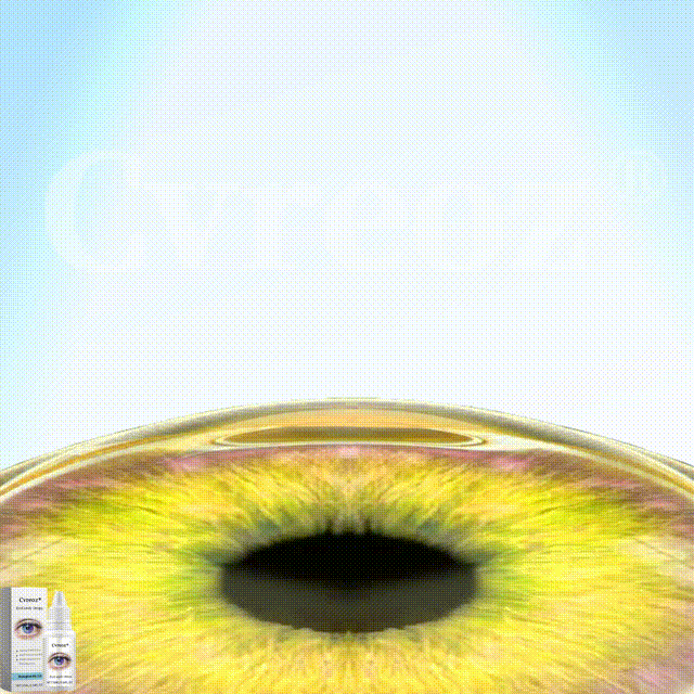 Last Day 49% OFF🔥Alcuras® EyeCandy Drops
