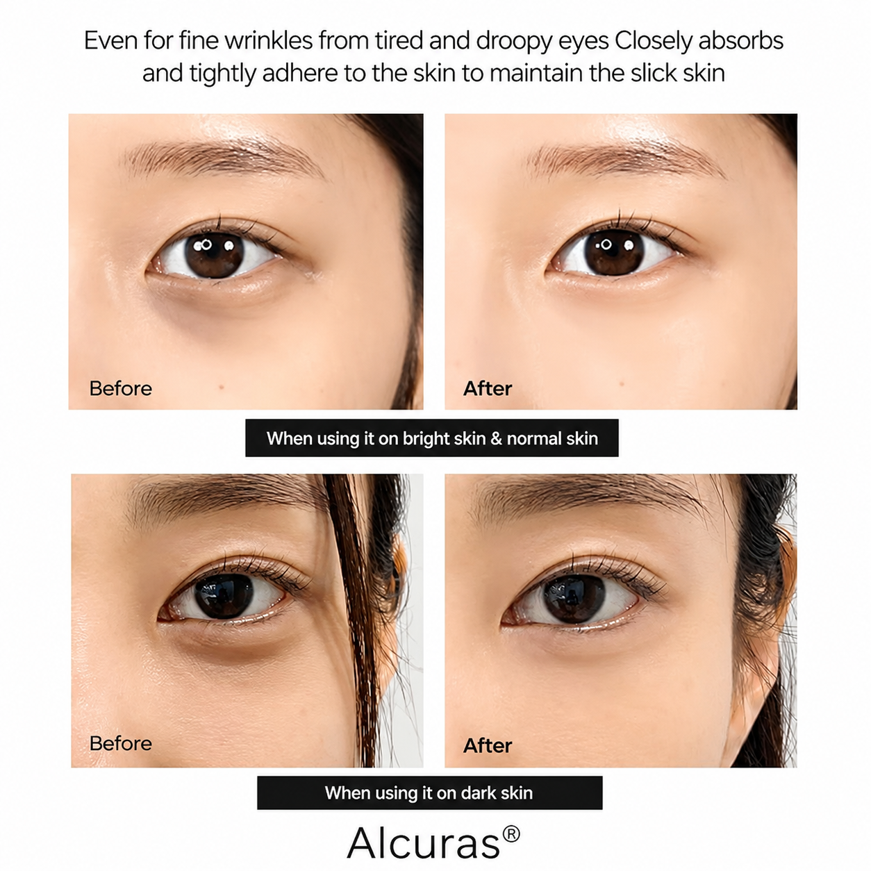 🔥Calcium Dark Spot Eye Cream